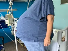 Rimosso ad Aviano un sarcoma addominale di 15 chili: la foto della paziente prima dell'intervento