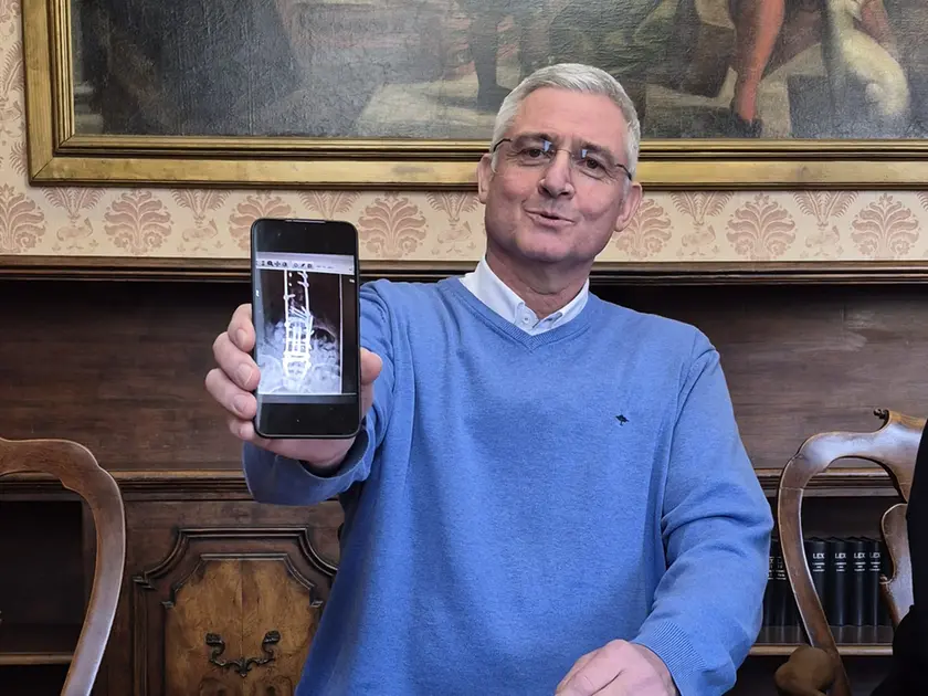 De Pellegrin mostra la radiografia della sua schiena