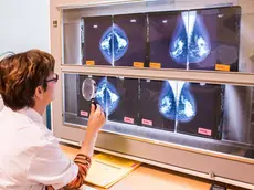La lettura di un esame mammografico