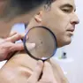 Un dermatologo mentre controlla un neo