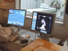 IL NUOVO PADIGLIONE DELL'OSPEDALE DI CISANELLO CHE OSPITA LA NEFROLOGIA, IL REPARTO PER LA DIALISI E GRAN PARTE DELLA RADIODIAGNOSTICA, DOTATO DI MACCHINARI AD ALTISSIMA SPECIALIZZAZIONE (NELLA FOTO Un OPERATOE SEGUE AL COMPUTER L'ESECUZIONE DI UNA TAC)